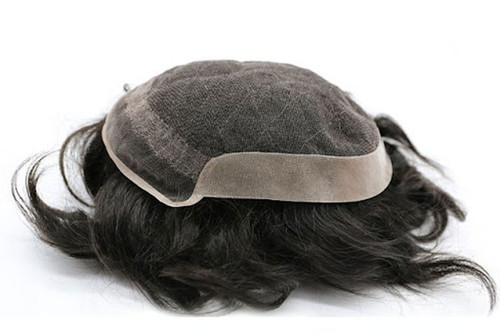 قیمت پروتز مو مردانه