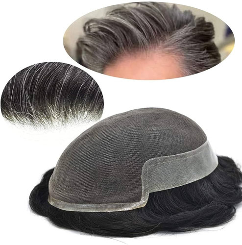 عوارض پروتز مو