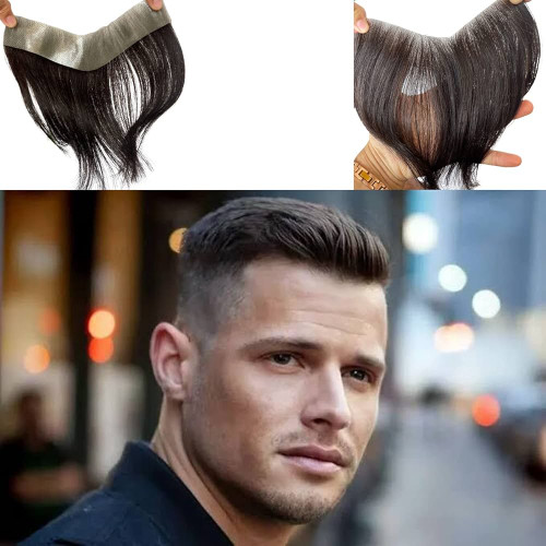 پروتز شقیقه مردانه