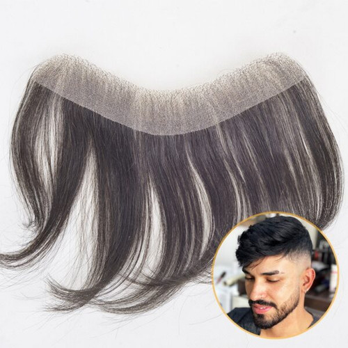 پروتز شقیقه مردانه